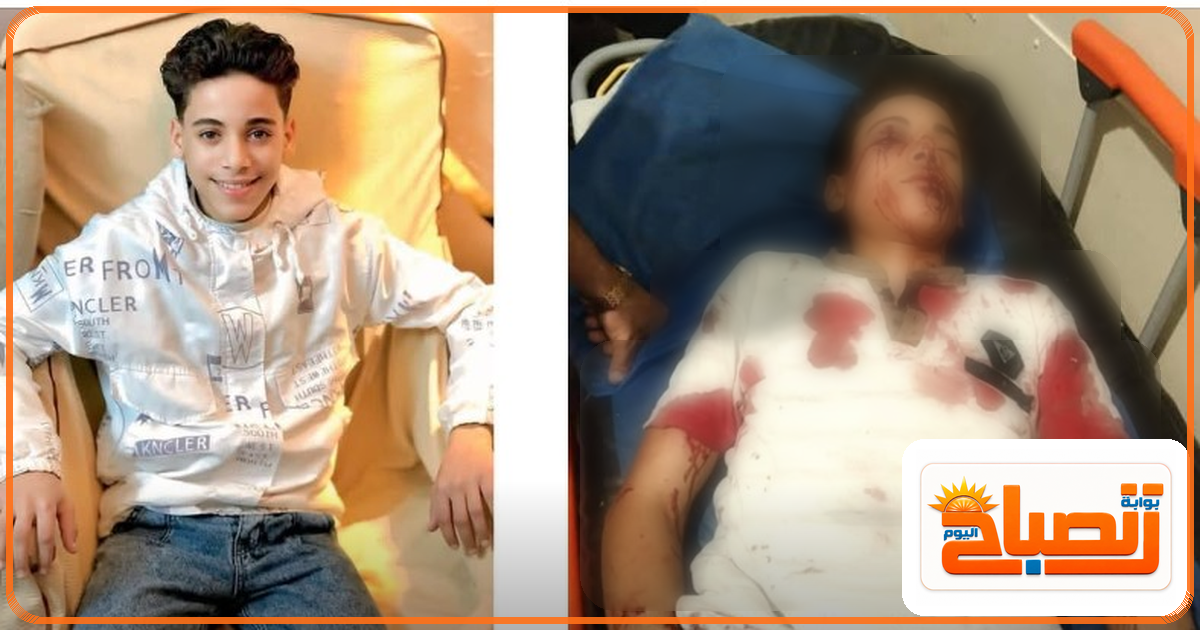 طلق ناري يحوّل فرحة مباراة المصري إلى كارثة.. إصابة خطيرة لشاب عمره 15 سنة